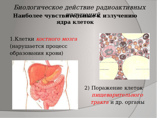 Биологическое действие радиоактивных излучений Наиболее чувствительные к излучению ядра клеток 1.Клетки костного мозга (нарушается процесс образования крови)  2) Поражение клеток пищеварительного тракта и др. органы