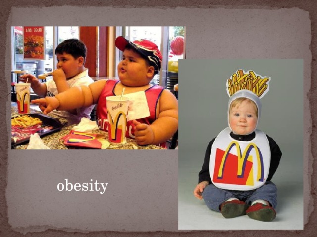 obesity