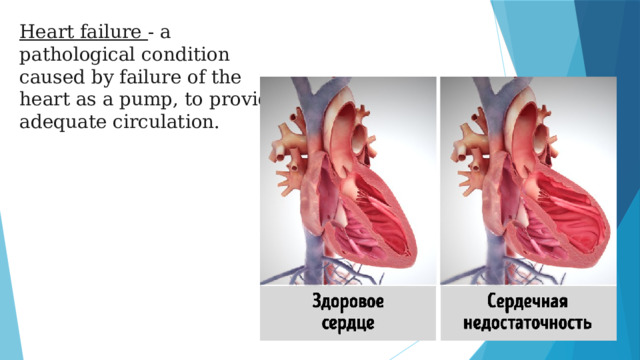 Heart failure - a pathological condition caused by failure of the heart as a pump, to provide adequate circulation.