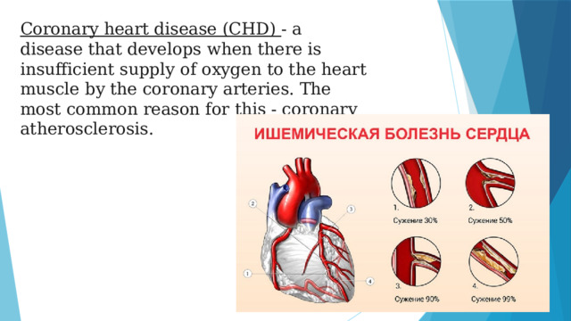 Coronary heart disease (CHD) - a disease that develops when there is insufficient supply of oxygen to the heart muscle by the coronary arteries. The most common reason for this - coronary atherosclerosis.