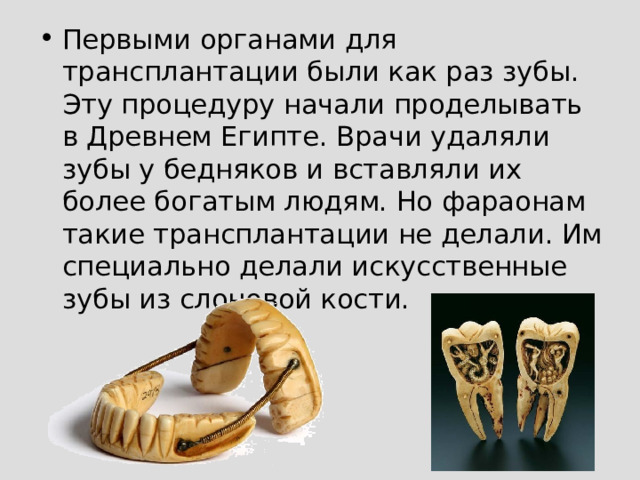 Первыми органами для трансплантации были как раз зубы. Эту процедуру начали проделывать в Древнем Египте. Врачи удаляли зубы у бедняков и вставляли их более богатым людям. Но фараонам такие трансплантации не делали. Им специально делали искусственные зубы из слоновой кости.